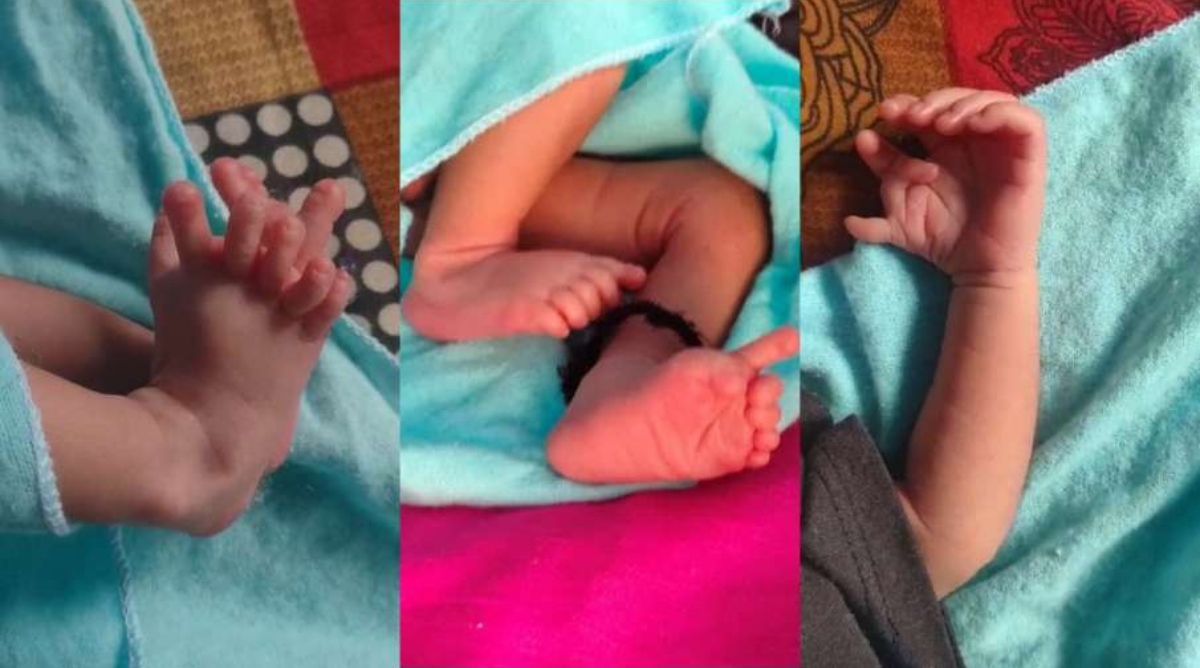 Baby born with 26 fingers in Rajasthan