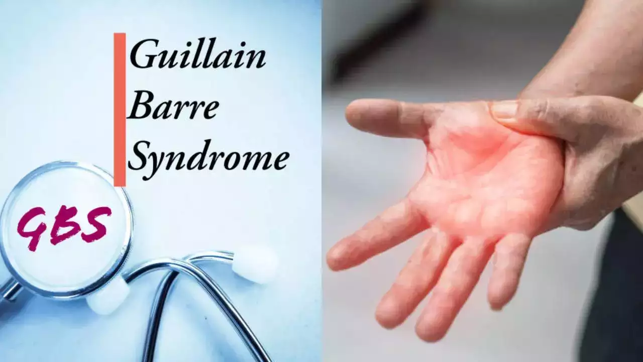 Guillain-Barre Syndrome
