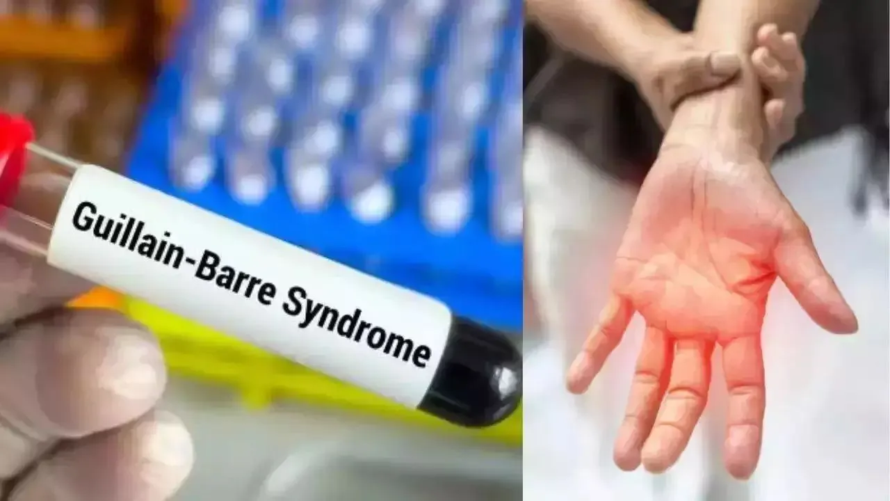 syndrome